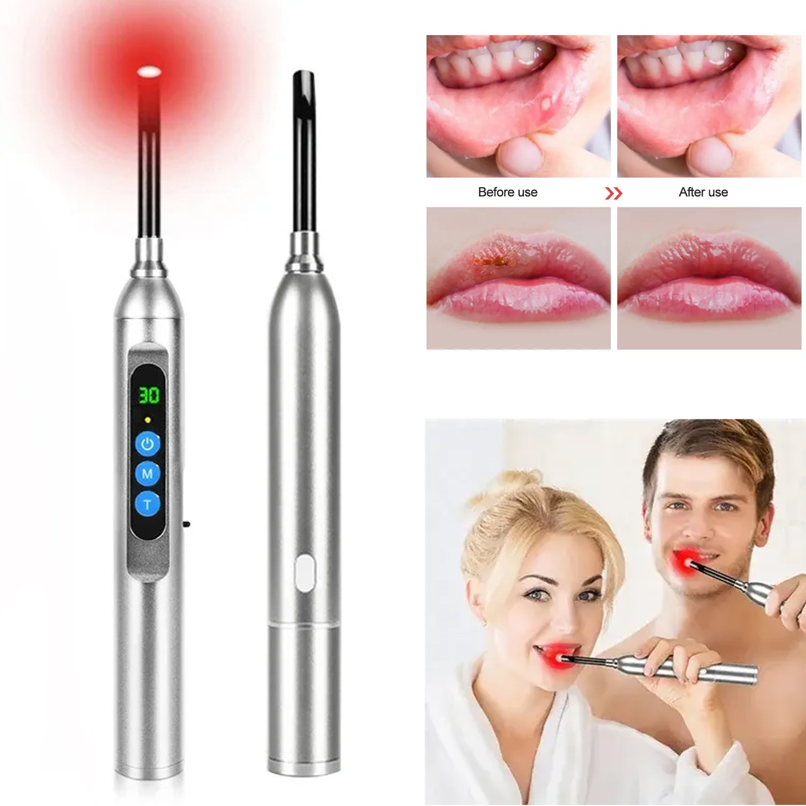 Galvanic Skin Sensor - Red Light Therapy Device Canker Sore