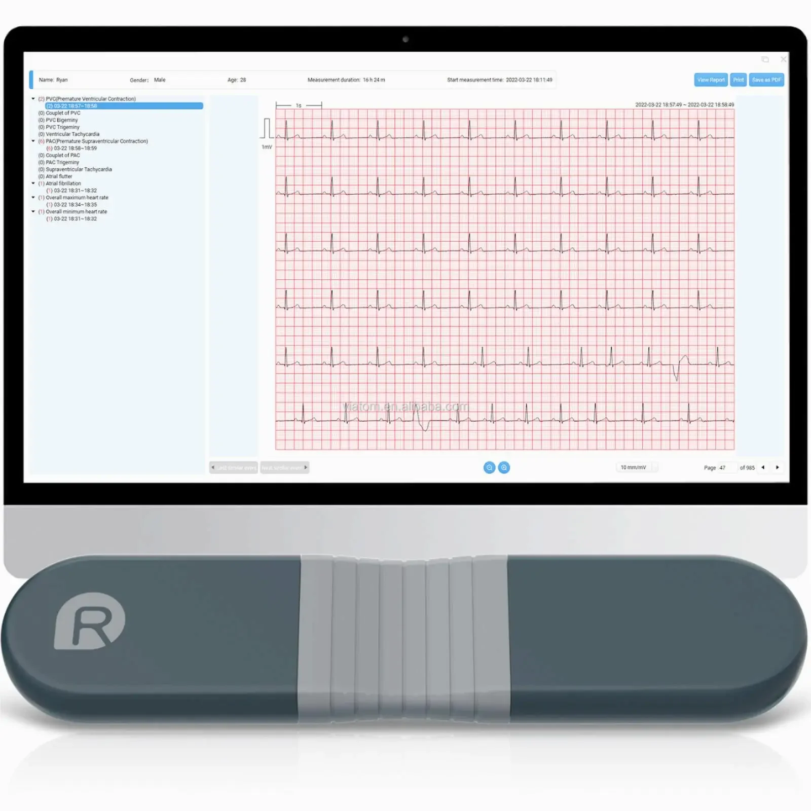 Wireless Bluetooth Dynamic Rec - Ecg Patch Monitor avaliação e preço